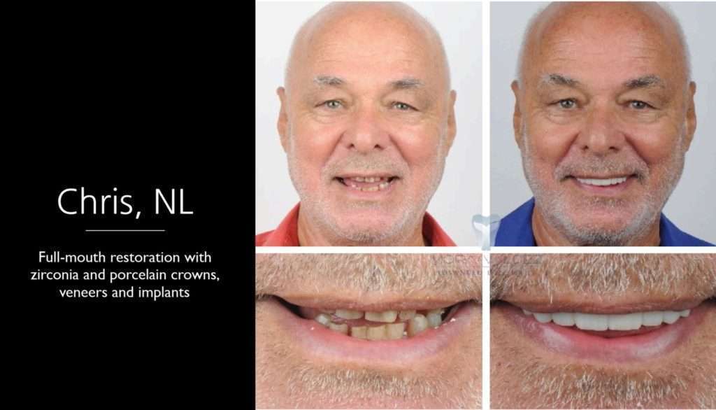 ODONTOLOGÍA COSMÉTICA